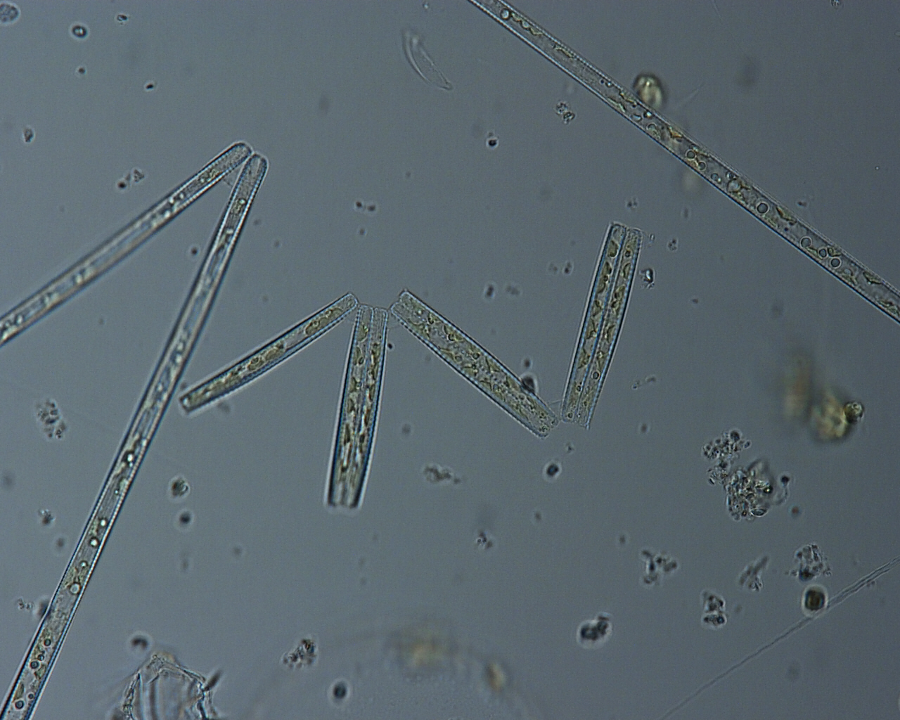 Dictyocha speculum